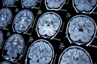 New Study Links Shingles to Cognitive Decline